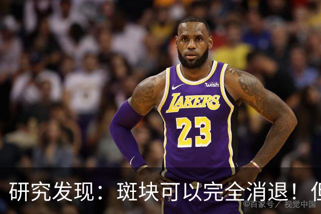 研究发现：斑块可以完全消退！但需要满足4个条件